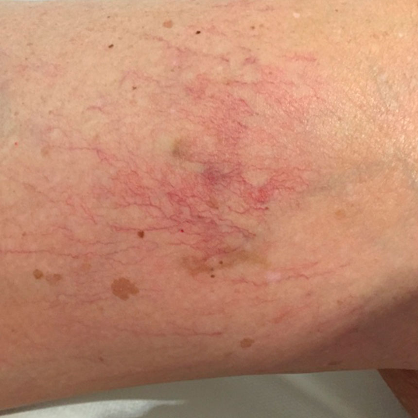 1263efter2behm2sproejter