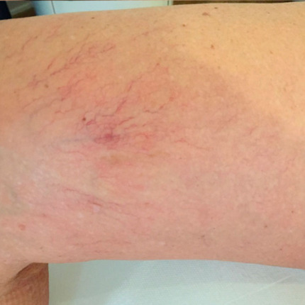 1264efter2behm2sproejter