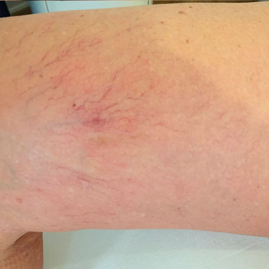 1264efter2behm2sproejter