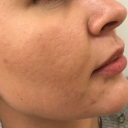 1341efter5behfrackinder