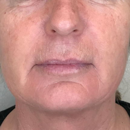 1455efter3750krkombi