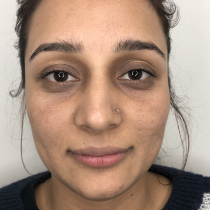 20-1-8-9-18-1_16-1-18-22-5-5-14-efter3