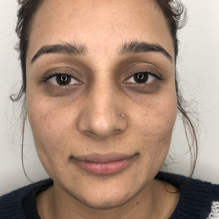 20-1-8-9-18-1_16-1-18-22-5-5-14-efter3