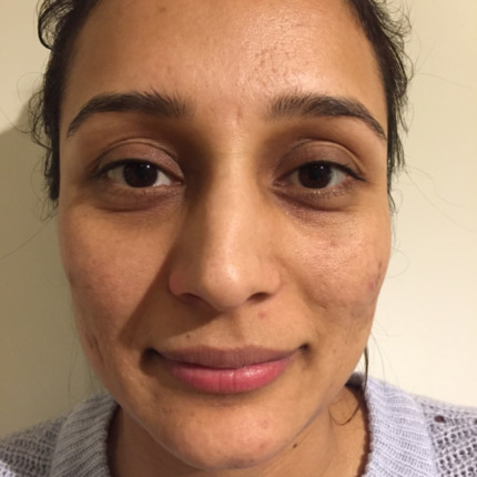 20-1-8-9-18-1_16-1-18-22-5-5-14-før3