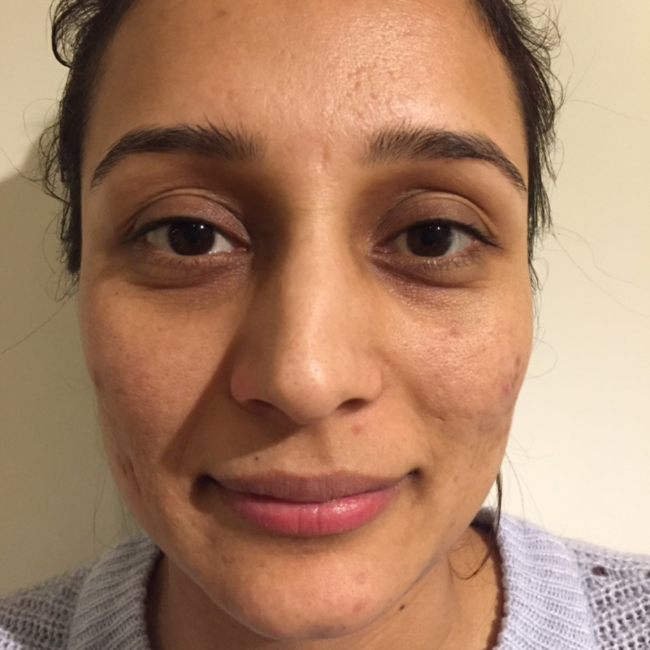 20-1-8-9-18-1_16-1-18-22-5-5-14-før3