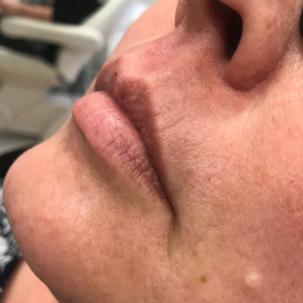 1-14-14-5-20-20-5_16-15-21-12-5-14-efter1