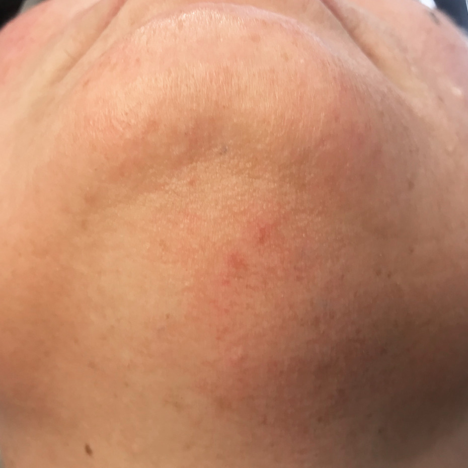 1-14-14-5-20-20-5_16-15-21-12-5-14-efter2