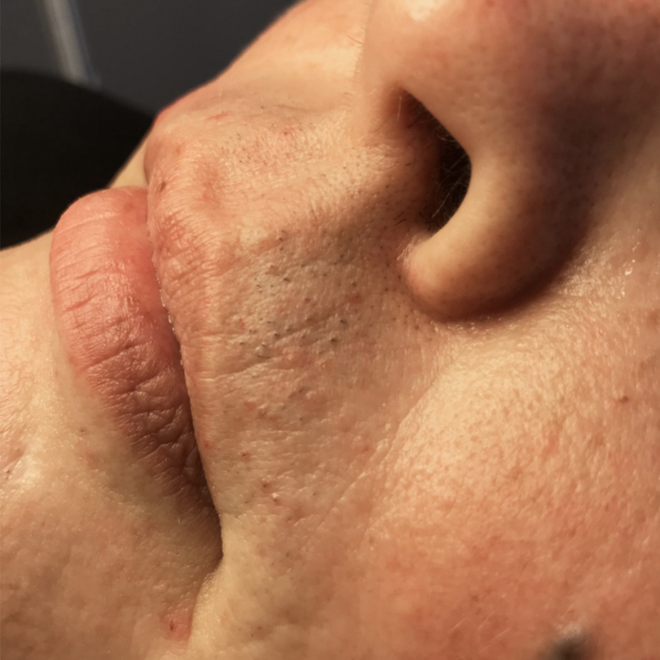 1-14-14-5-20-20-5_16-15-21-12-5-14-før1