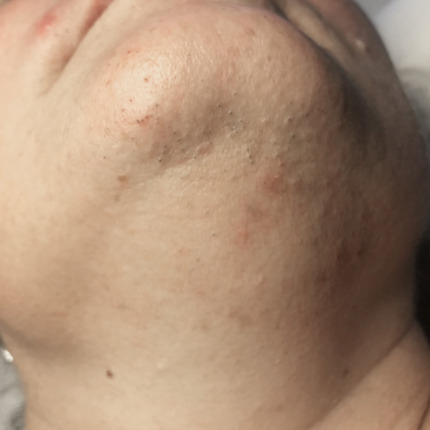 1-14-14-5-20-20-5_16-15-21-12-5-14-før2