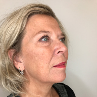 1DorritGidselFØR