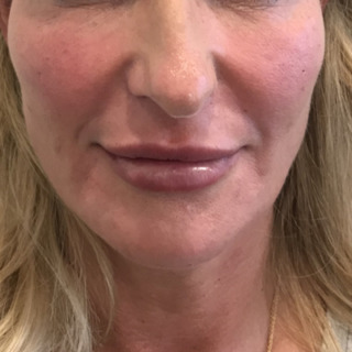 1JoanKristensenEFTER