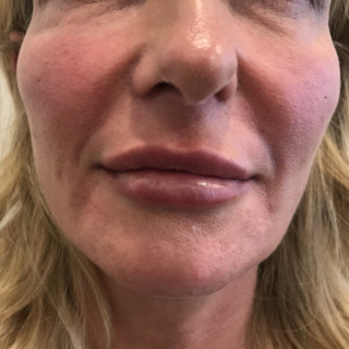3JoanKristensenEFTER