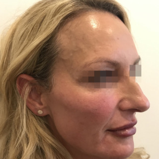 4JoanKristensenEFTER