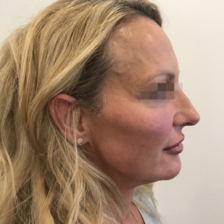 5JoanKristensenEFTER