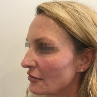 6JoanKristensenEFTER