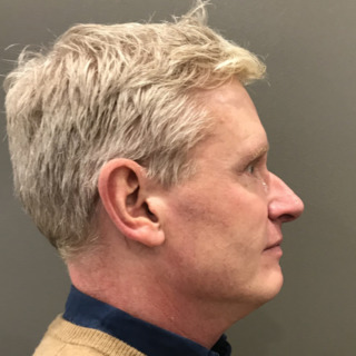 Martin-efter3