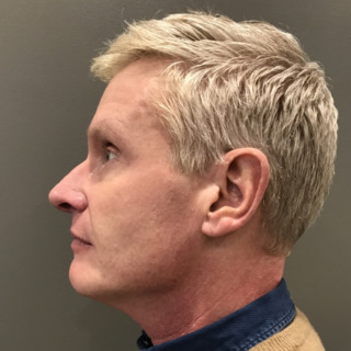 Martin-efter4