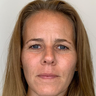 2EFTER