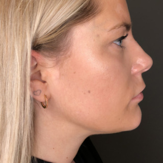 Christina Blaaberg -HAGE_1EFTER