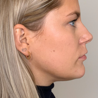 Christina Blaaberg -HAGE_1FØR