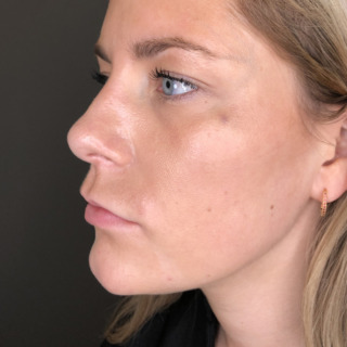 Christina Blaaberg -HAGE_2EFTER