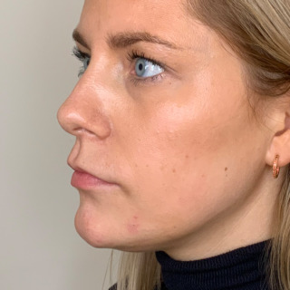 Christina Blaaberg -HAGE_2FØR