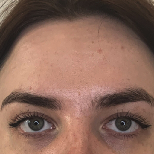 Ditte Brodersen Glabella_1FØR