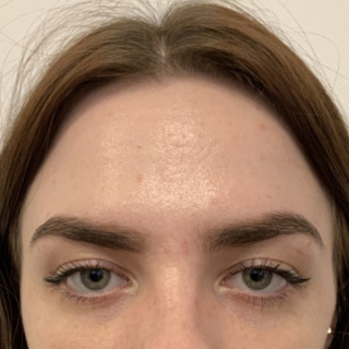Ditte Brodersen Glabella_2EFTER