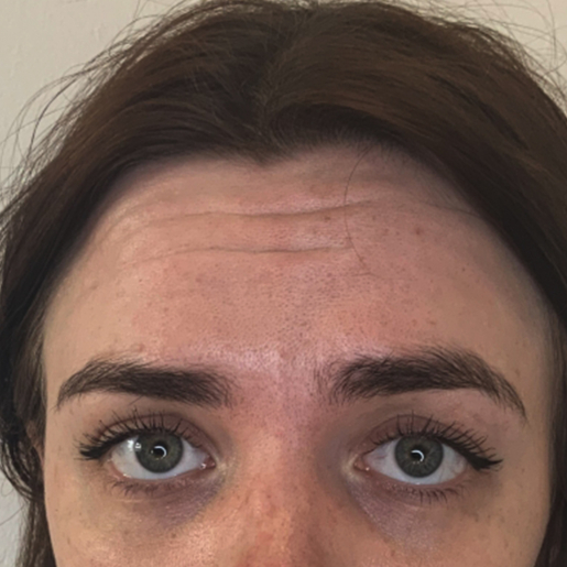 Ditte Brodersen Glabella_2FØR