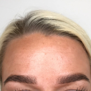 Josefine Olsen_1EFTER