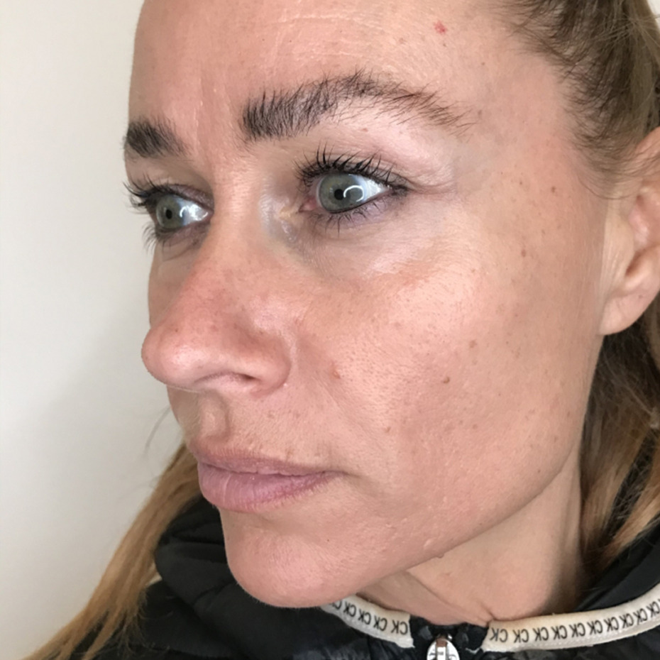 Sanne Messer - Furer næse til mund_2EFTER