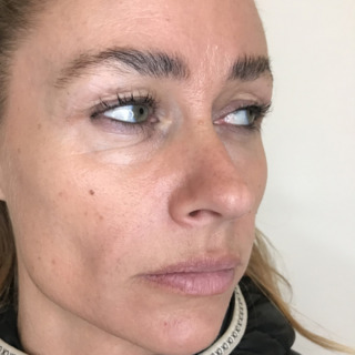 Sanne Messer - Furer næse til mund_3EFTER