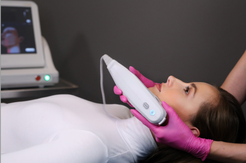 Ultherapy