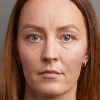 F-efter-1-1080x1080
