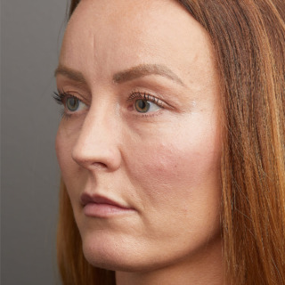 F-efter-7-1080x1080