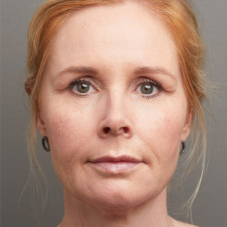I-efter-1-1080x1080