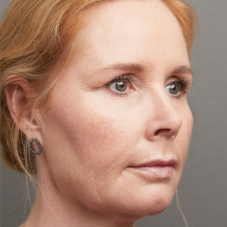 I-efter-8-1080x1080