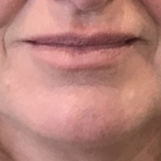 efter-laeber