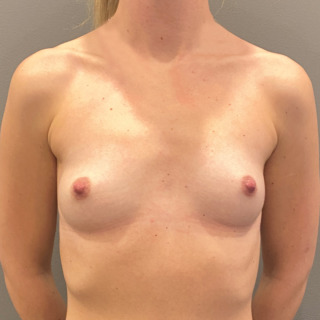 Website-brystforstorrende-operation-foer1