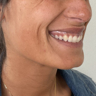Website-gummismile-laeber-lipflip-foer3