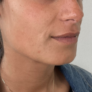 Website-gummismile-laeber-lipflip-foer4