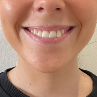 Website-laeber-lipflip-foer2