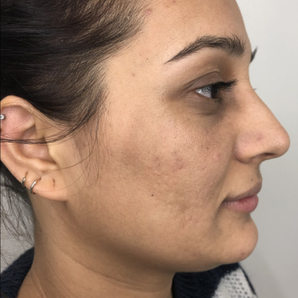 20-1-8-9-18-1_16-1-18-22-5-5-14-efter2