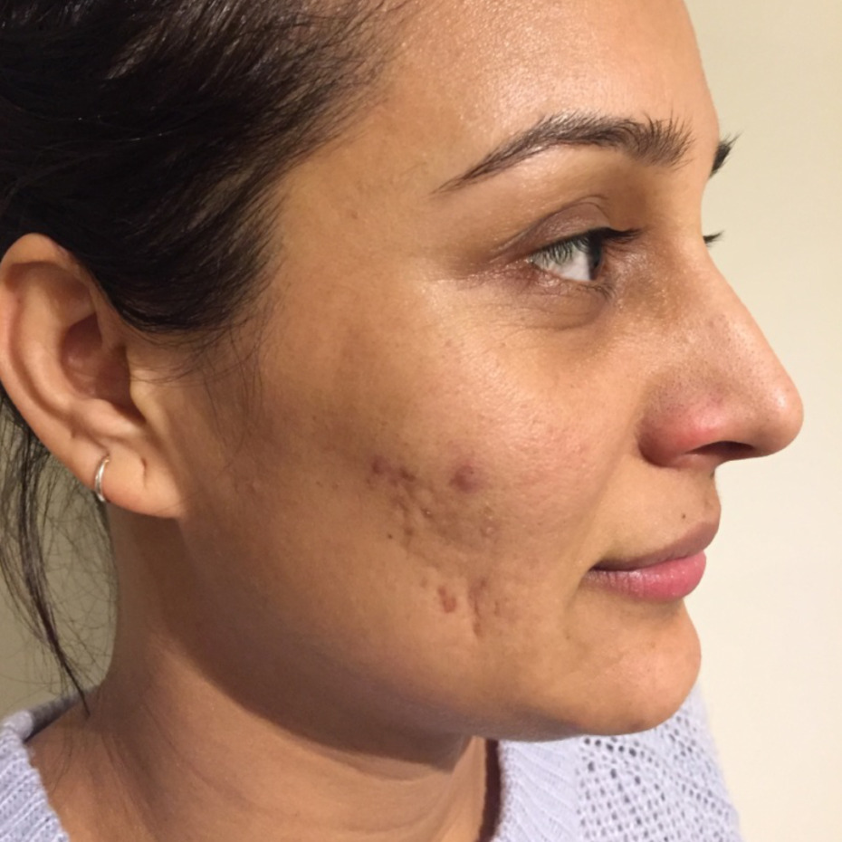 20-1-8-9-18-1_16-1-18-22-5-5-14-før2