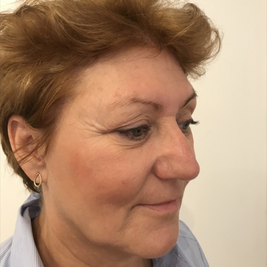 20-9-14-1_2-15-22-9-5-143Før