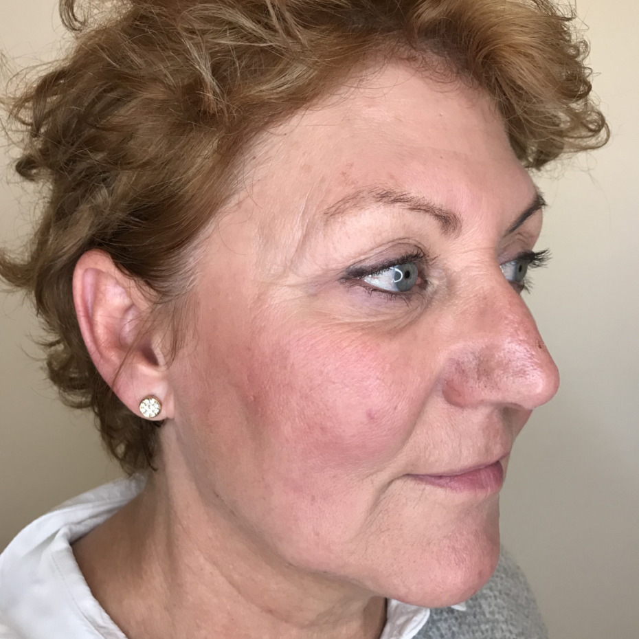 20-9-14-1_2-15-22-9-5-143Kontrol