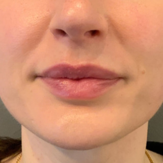 Laeber-hage-efter1