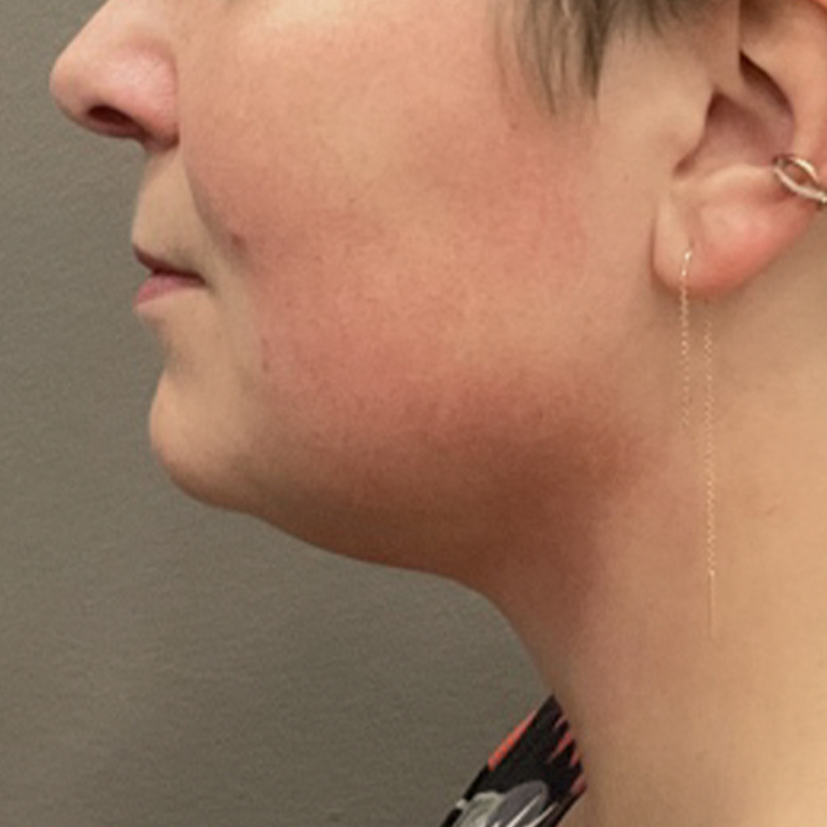 Cooltech-hage-efter1-website