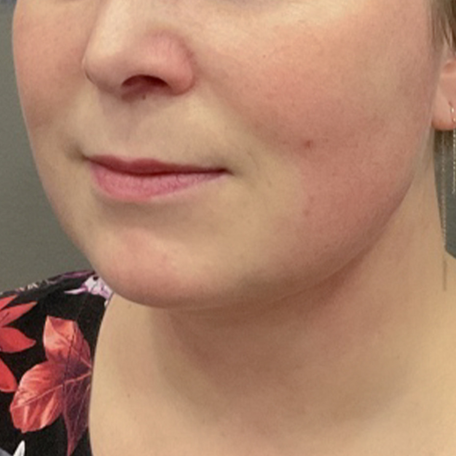 Cooltech-hage-efter2-website