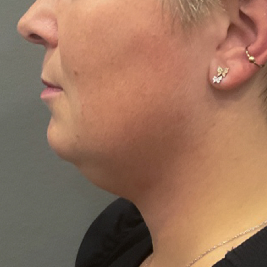 Cooltech-hage-før1-website